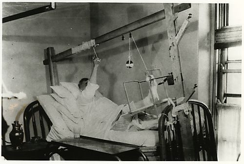 Patient with leg in traction.
