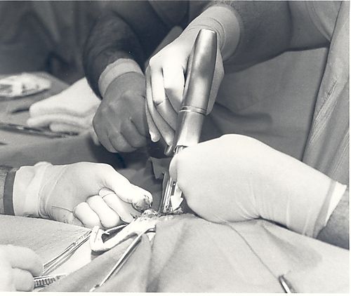 Montefiore Hospital staplers in surgery